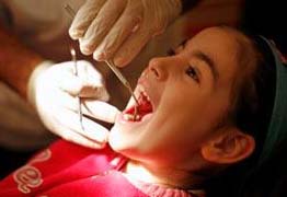 Dental Implants Image 3