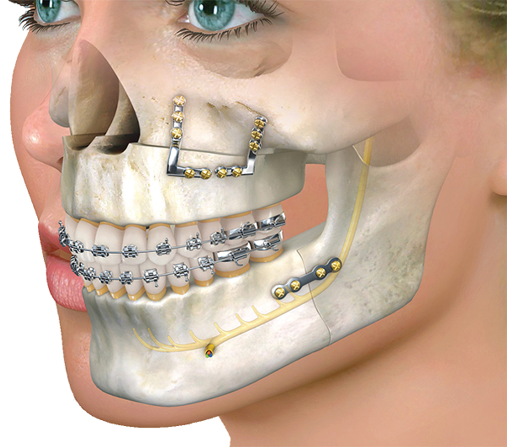 Tooth Scaling Image 3
