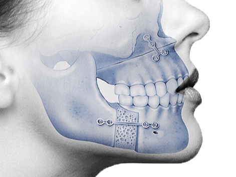 Tooth Scaling Image 2