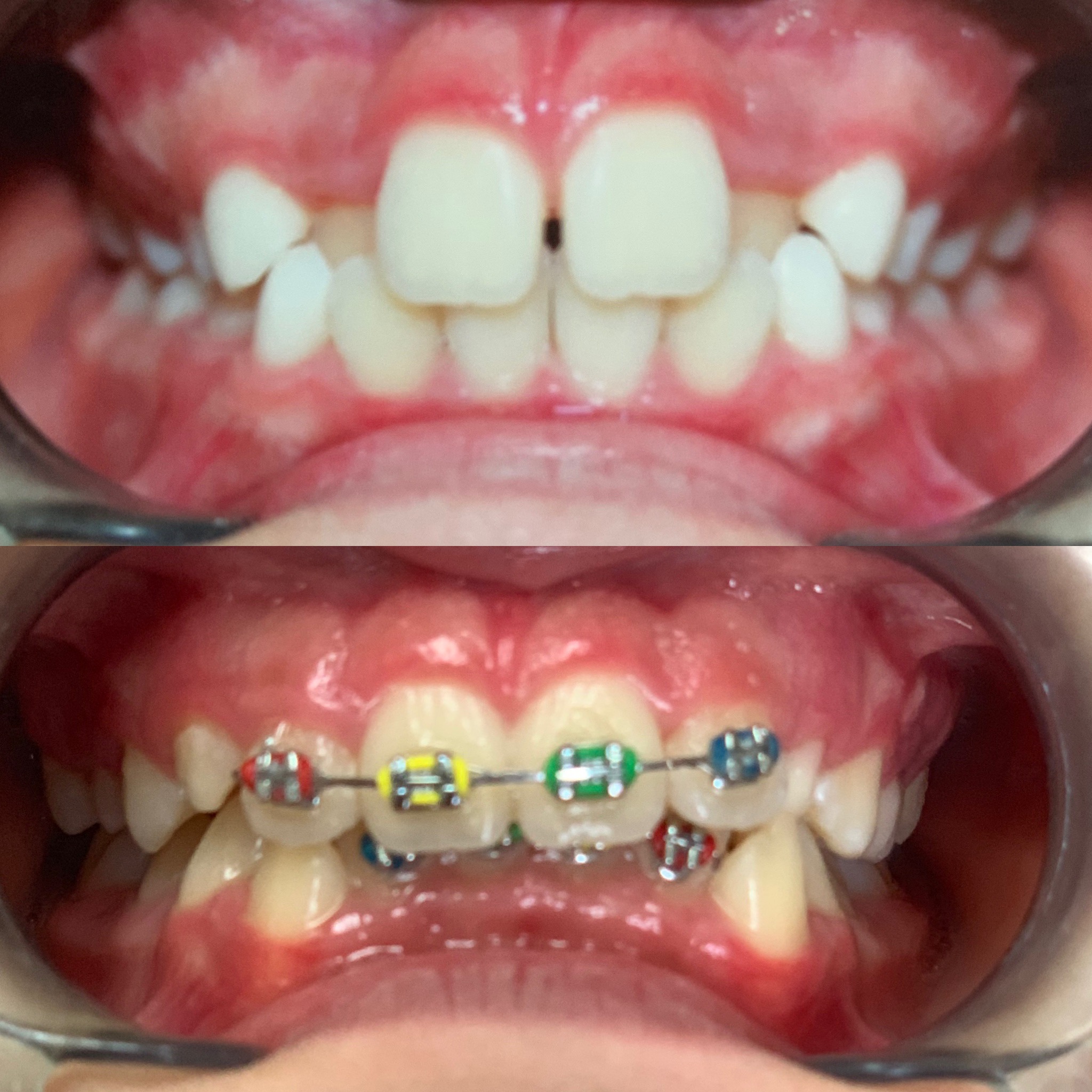 Dental Implants Image 2