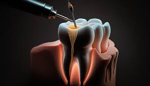 Dental Implants Image 2